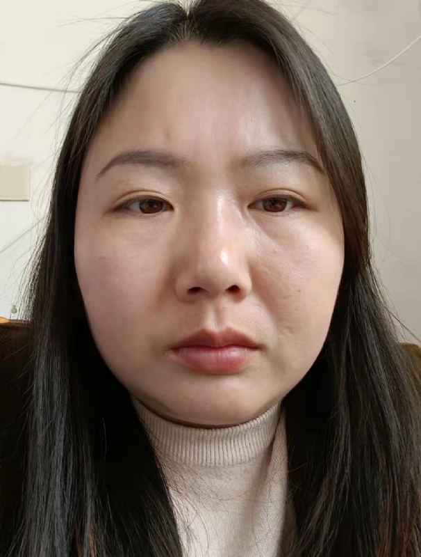 云飞儿的第一张照片--湖南残疾人相亲网